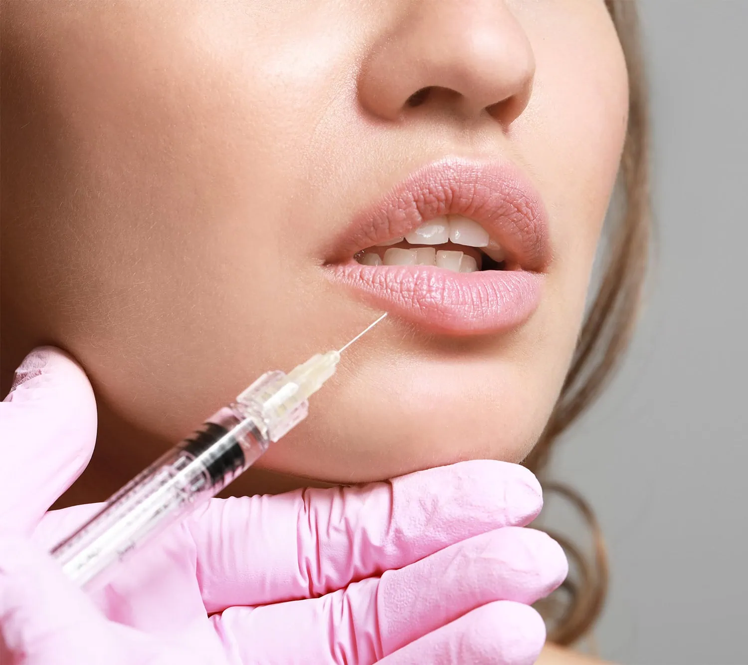 lip fillers