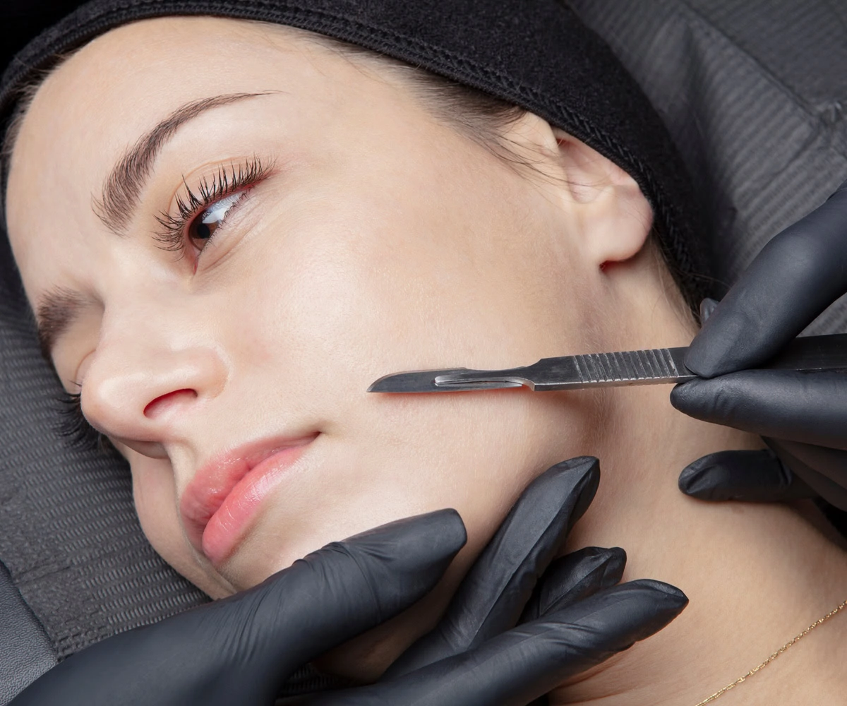 Dermaplaning Treatment in Wilmington, NC