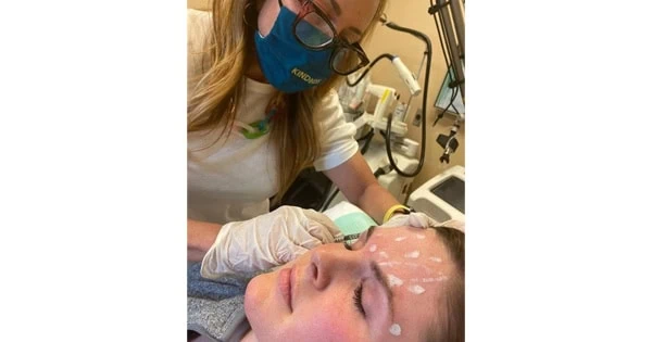 dermal filler injections