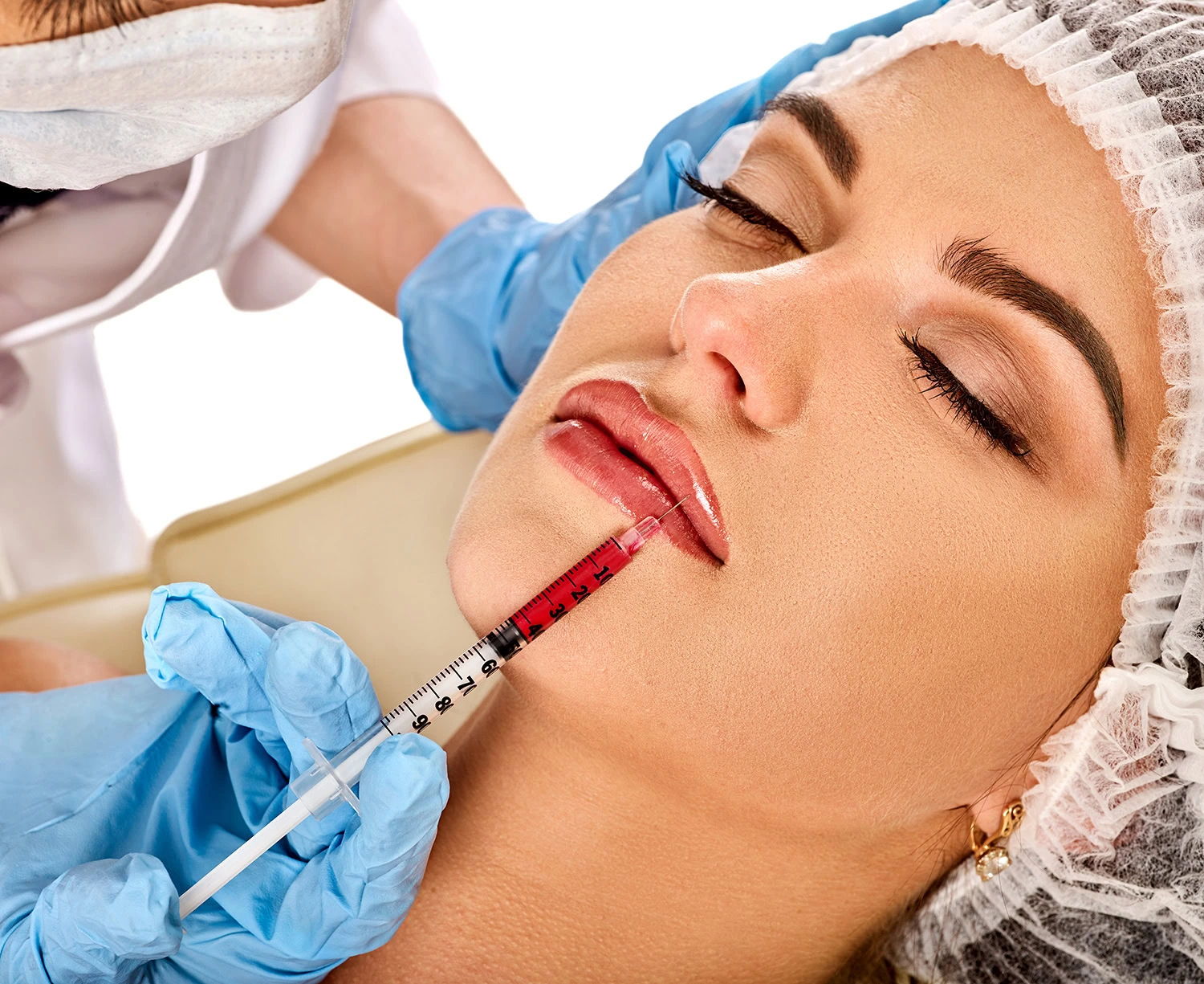 lip fillers