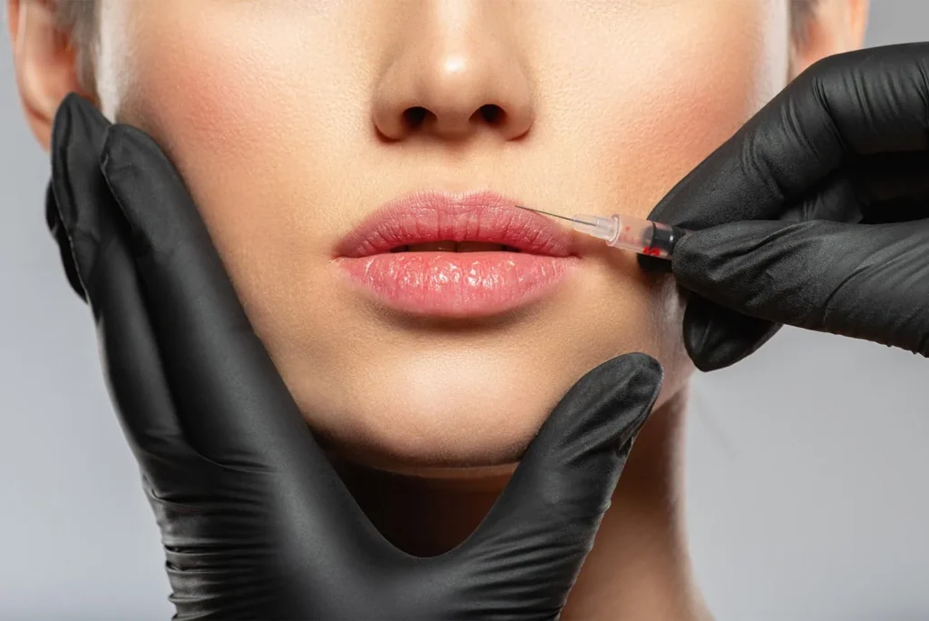 Radiesse Services United Medical and Aesthetics