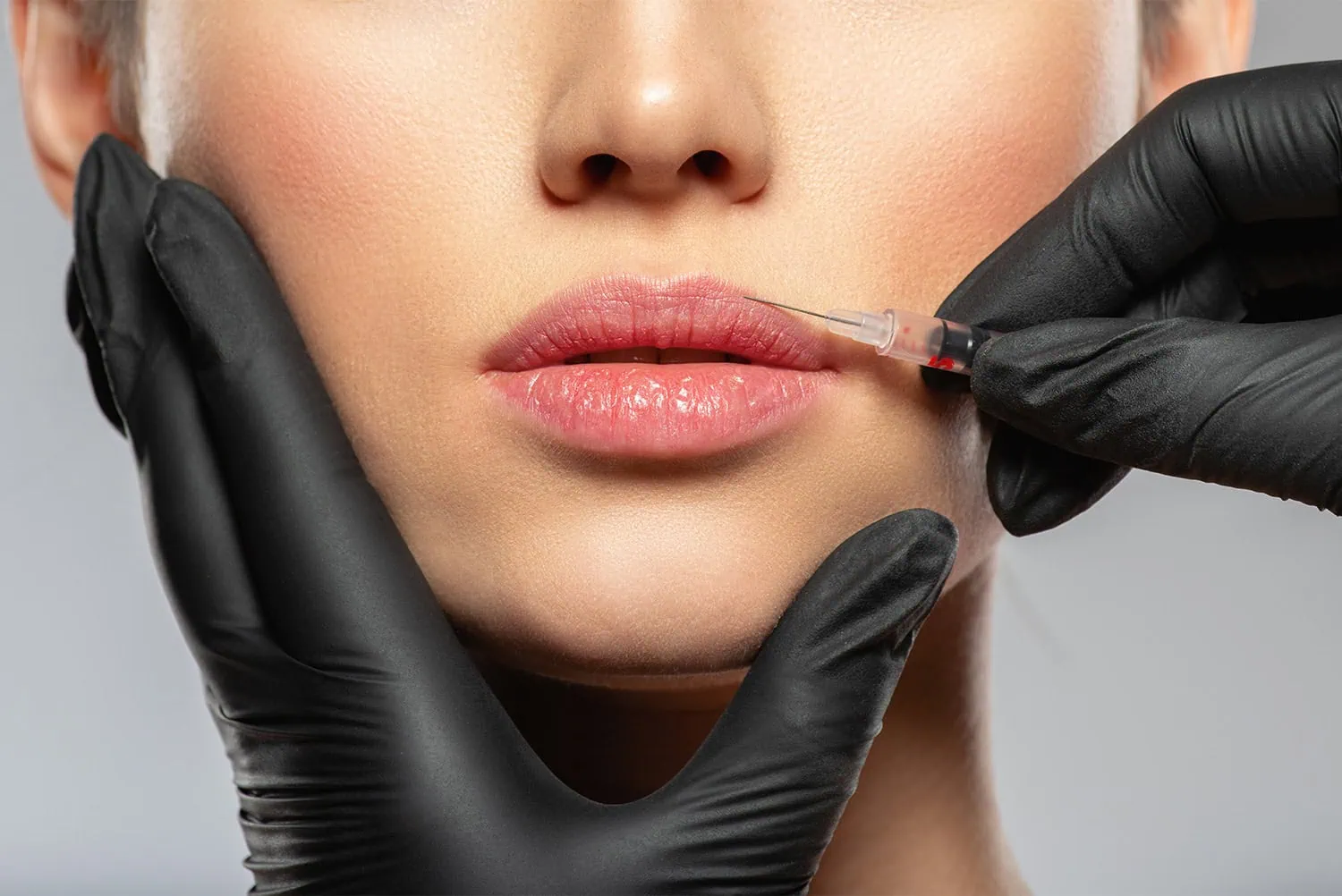 Radiesse Services United Medical and Aesthetics