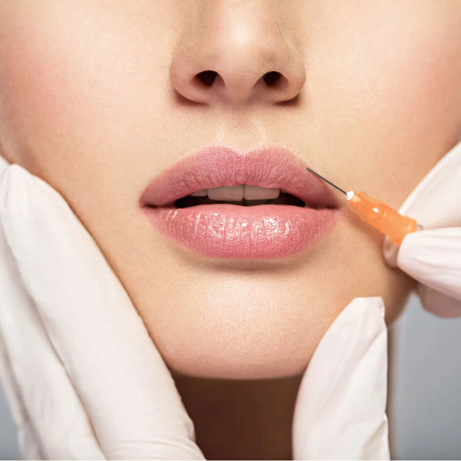 Revanesse Lips Services United Medical and Aesthetics