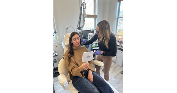 microneedling facial