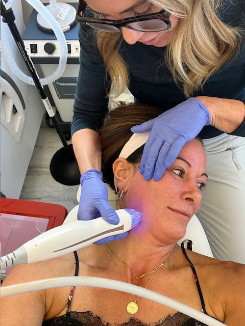 microneedling facial