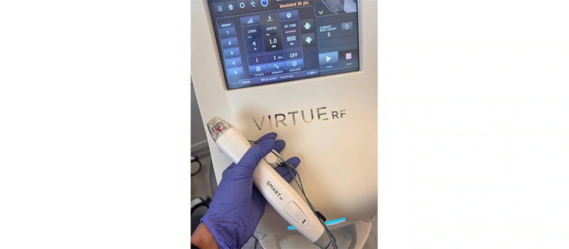 microneedling facial