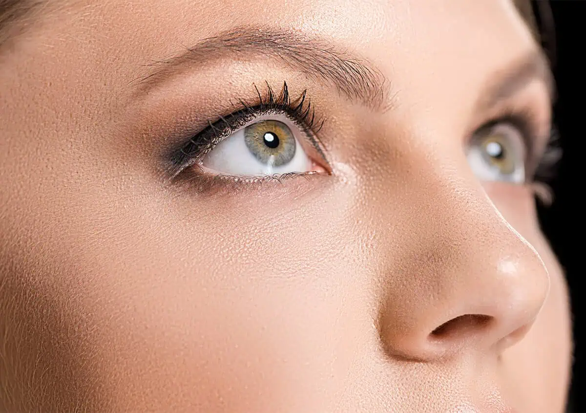 dermal fillers under eyes