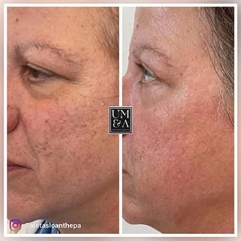 Helix-b&a-unitedmedicalandaesthetics-eleven