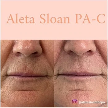 Helix-b&a-unitedmedicalandaesthetics-fifteen