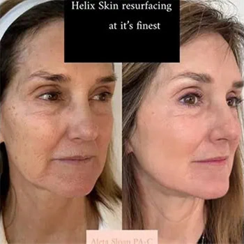 Helix-b&a-unitedmedicalandaesthetics-one