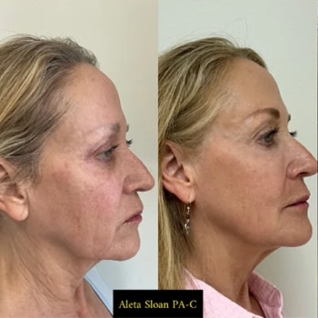 Helix-b&a-unitedmedicalandaesthetics-six