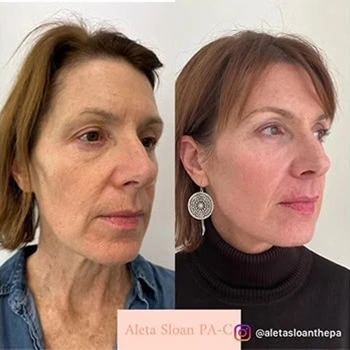Helix-b&a-unitedmedicalandaesthetics-ten