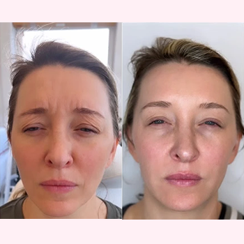 Neuromodulators-b&a-one