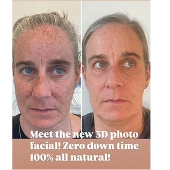 Nordyls-Light-and-Bright-b&a-fourteen