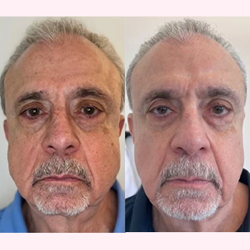 Nordyls-Light-and-Bright-b&a-nine