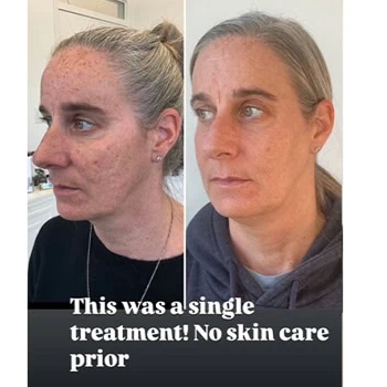 Nordyls-Light-and-Bright-b&a-seventeen