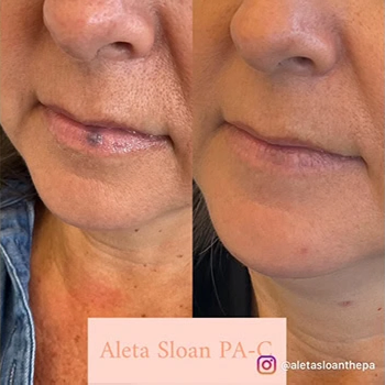 Nordyls-Light-and-Bright-b&a-sixteen