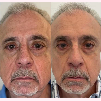 Nordyls-Light-and-Bright-b&a-ten