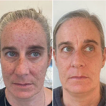 Nordyls-Light-and-Bright-b&a-thirteen