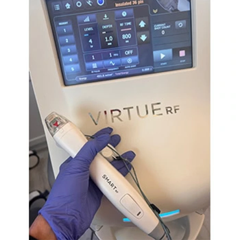 Virtue-RF-Microneedling-b&a-three