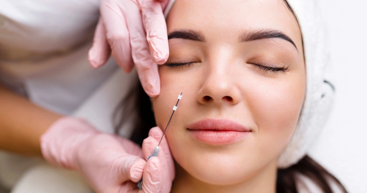 Woman receiving PDO Thread Lift in Wilmington, NC for skin tightening and natural facial rejuvenation.