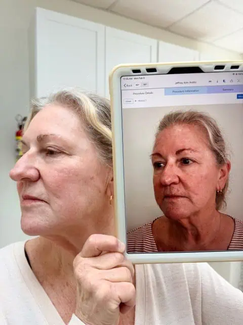 UltraClear Laser Treatment in Wilmington, NC