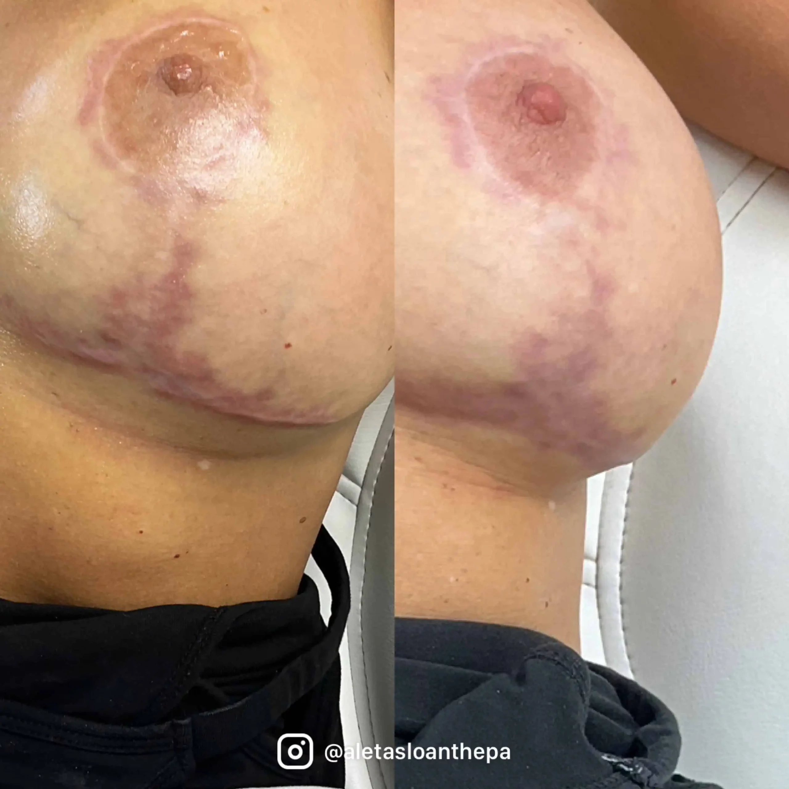 scar before-and-after