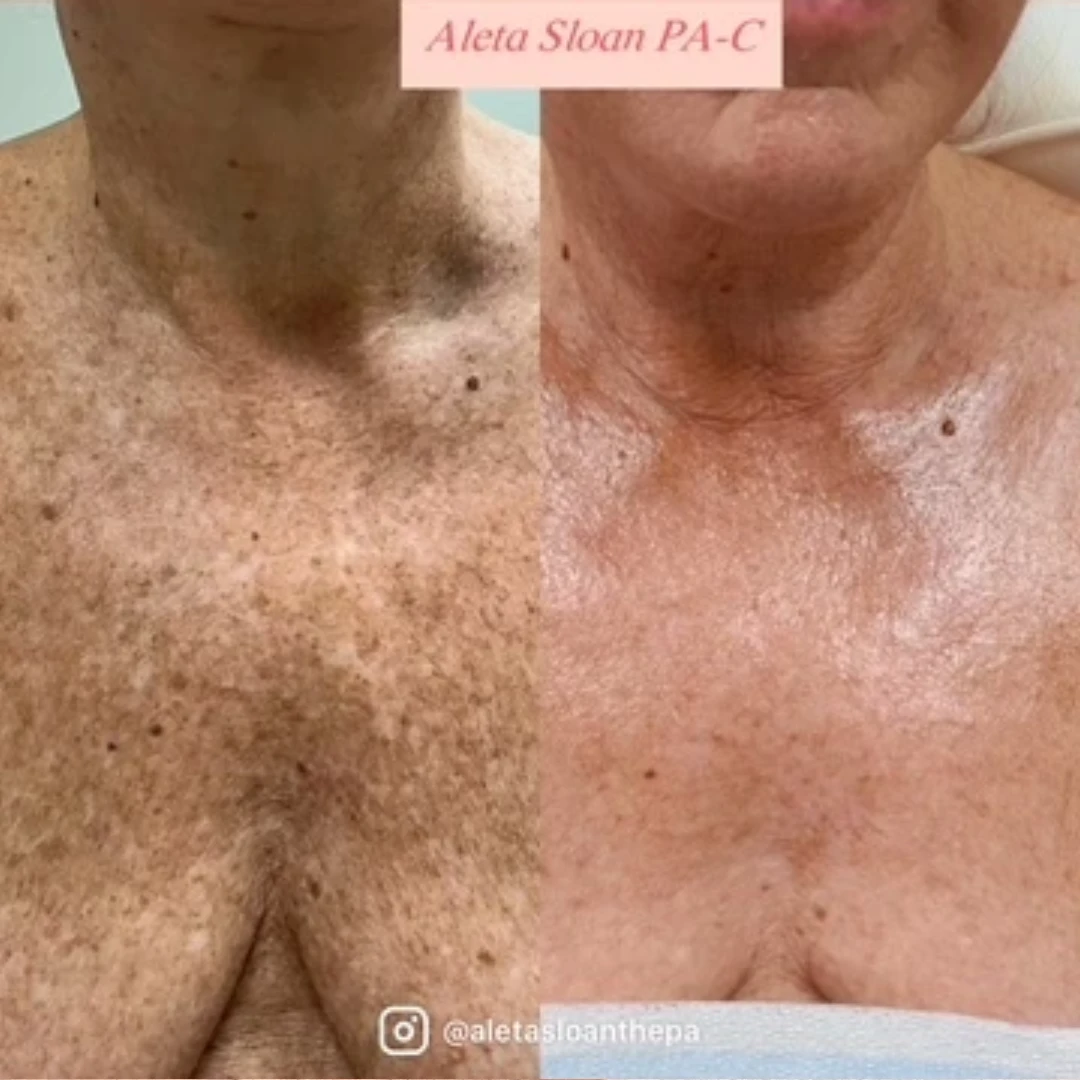 Nordlys-Before-After (2)