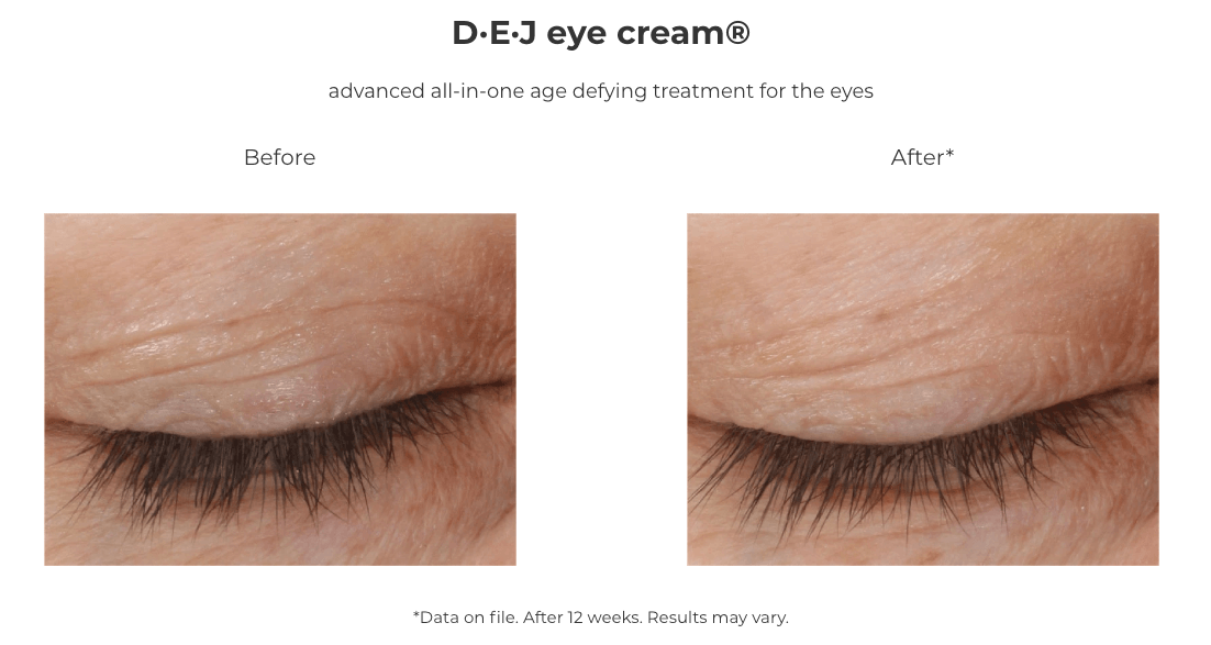 eye cream before and after compare
