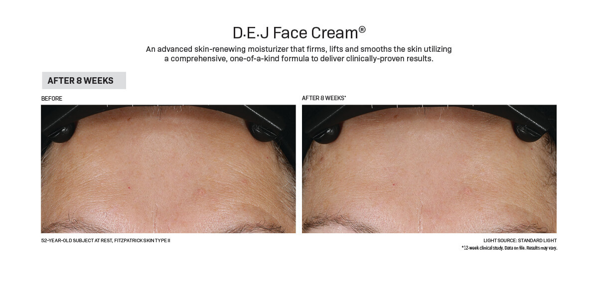 D.E.j face cream before after unitedmedicalandaesthetics