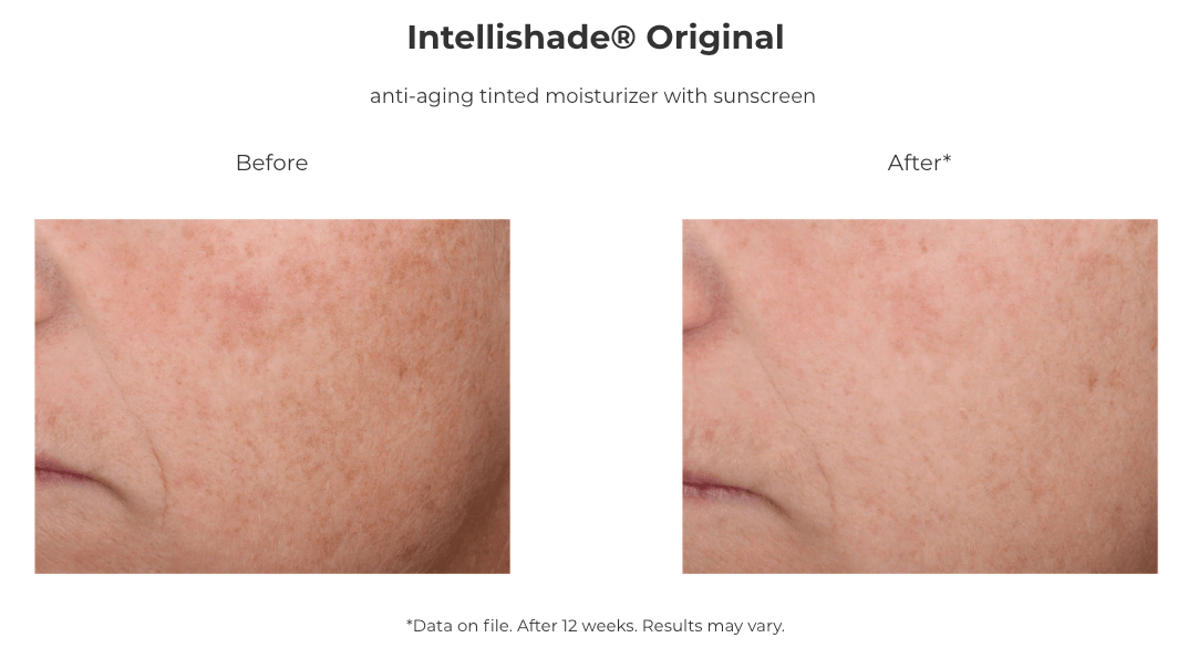 Intellishade before after compare