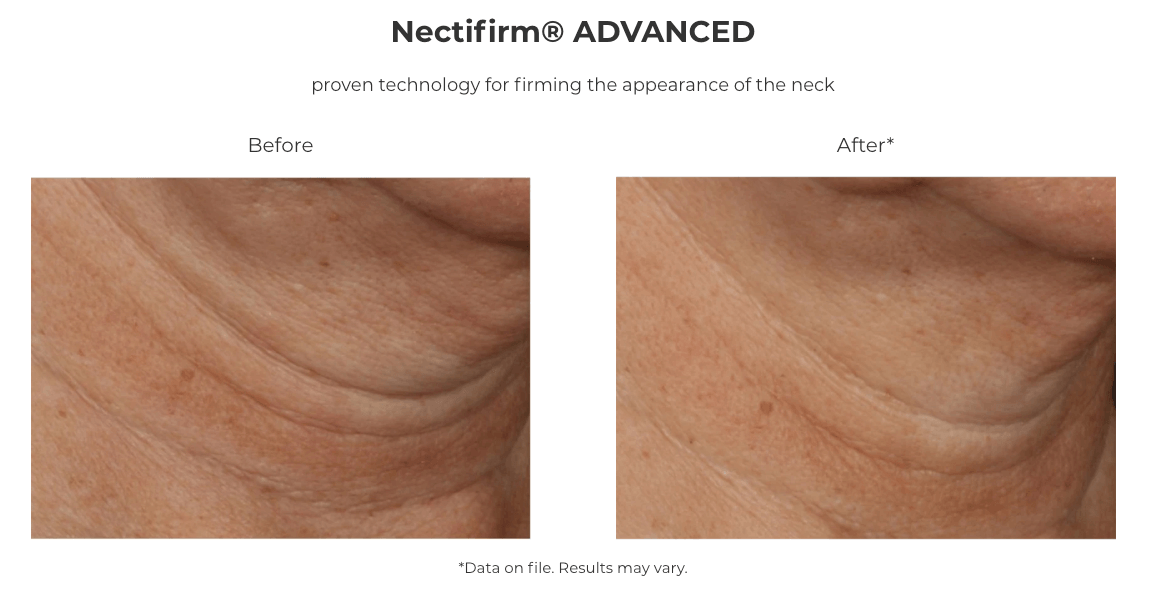 Nectifirm advanced before after compare