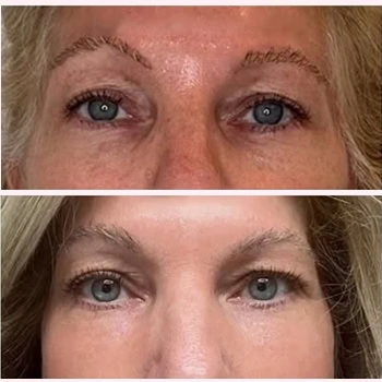Helix in Wilmington, NC | United Medical & Aesthetics