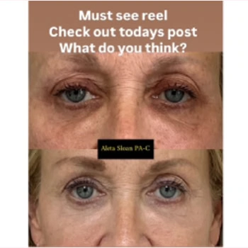 Helix in Wilmington, NC | United Medical & Aesthetics