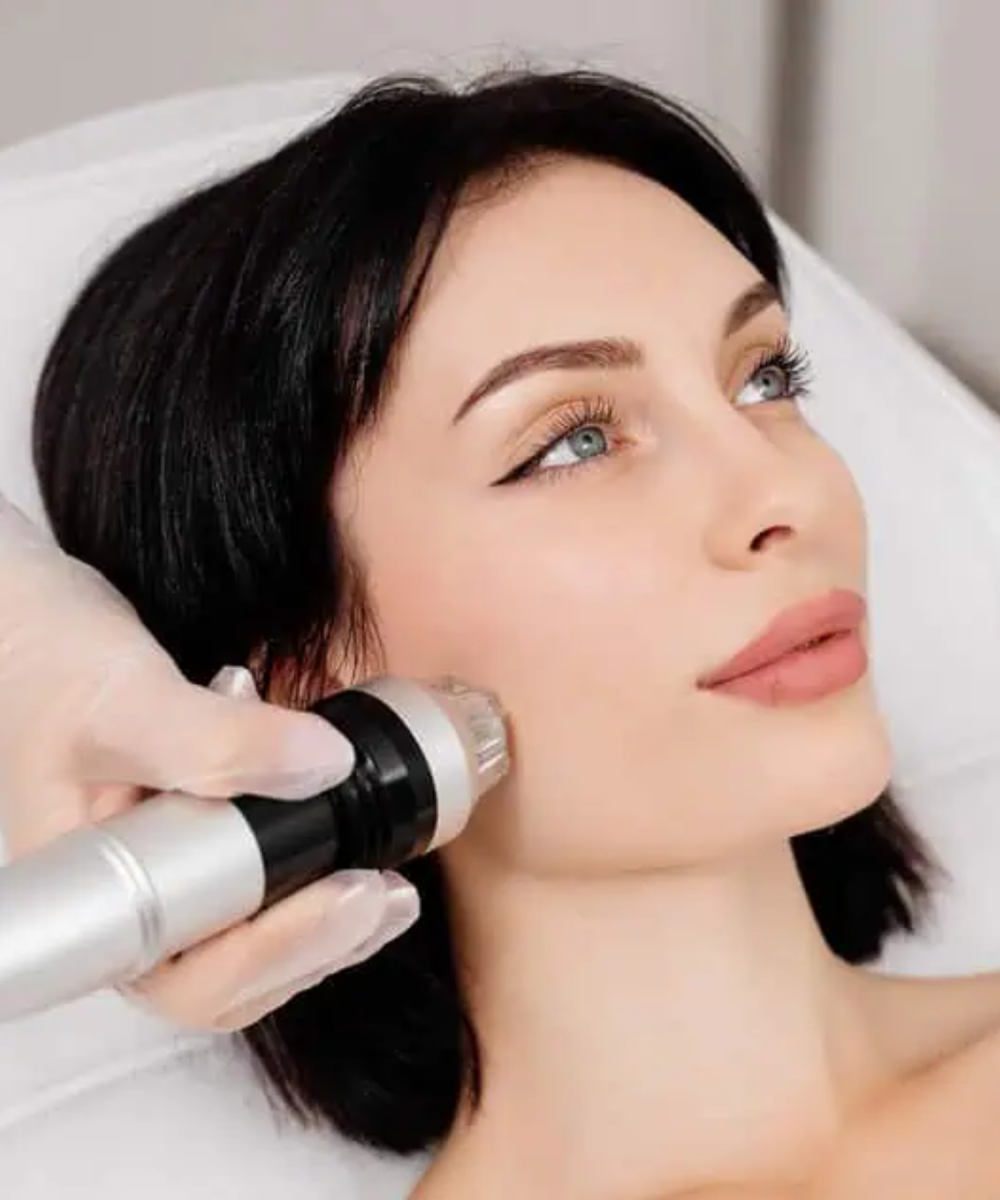 Virtue RF Microneedling in Wilmington, NC