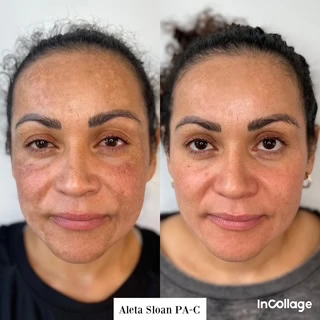 Facial Rejuvenation in Wilmington, NC at United Medical And Aesthetics