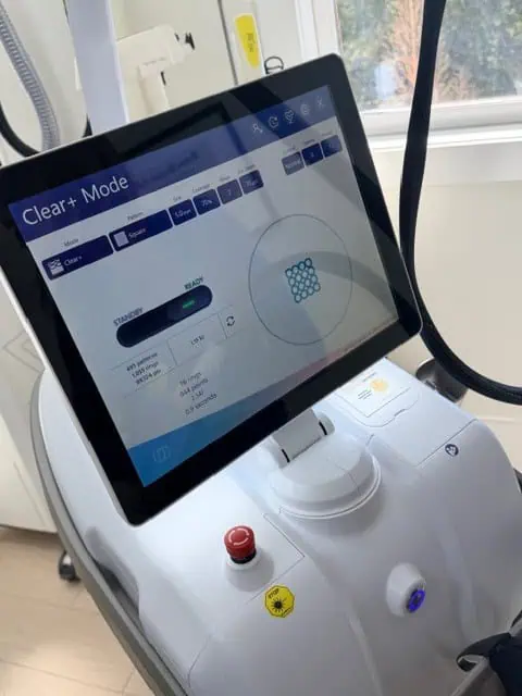 UltraClear Laser Treatment in Wilmington, NC
