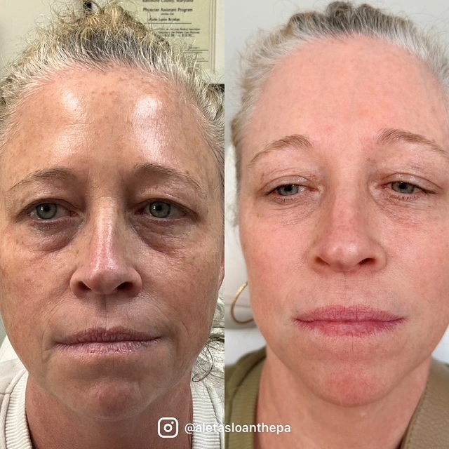 Helix in Wilmington, NC | United Medical & Aesthetics