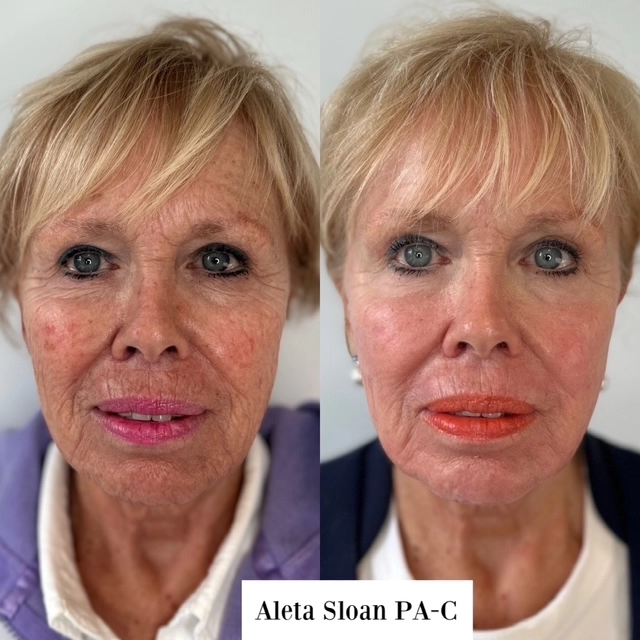 helix-co2-ba-7